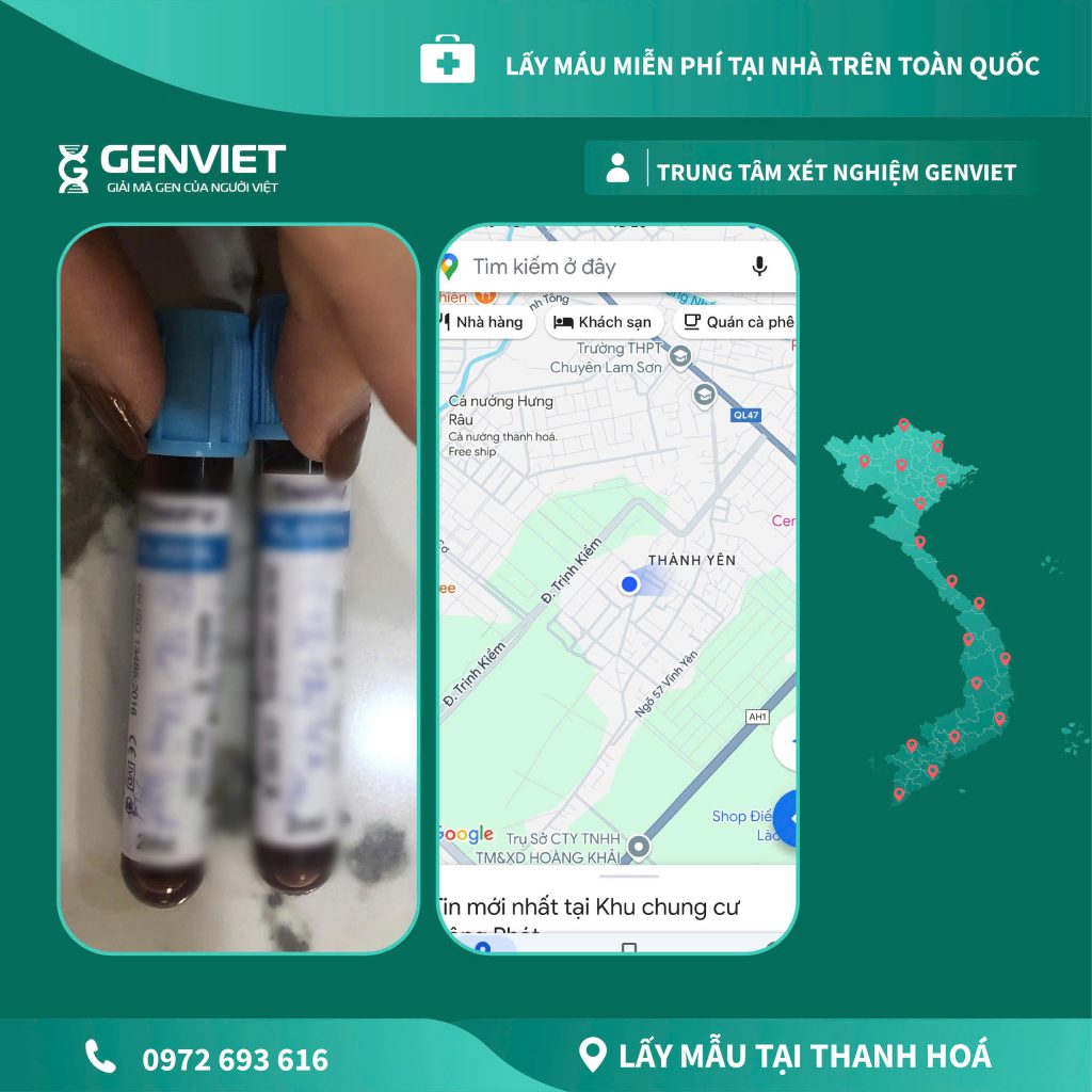 Dịch vụ xét nghiệm và sàng lọc trước sinh Gen Việt