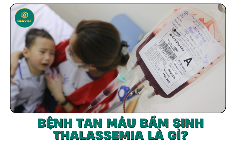 benh-tan-mau-bam-sinh-thalassemia-la-gi