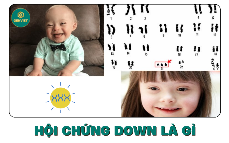 hoi-chung-down-la-gi