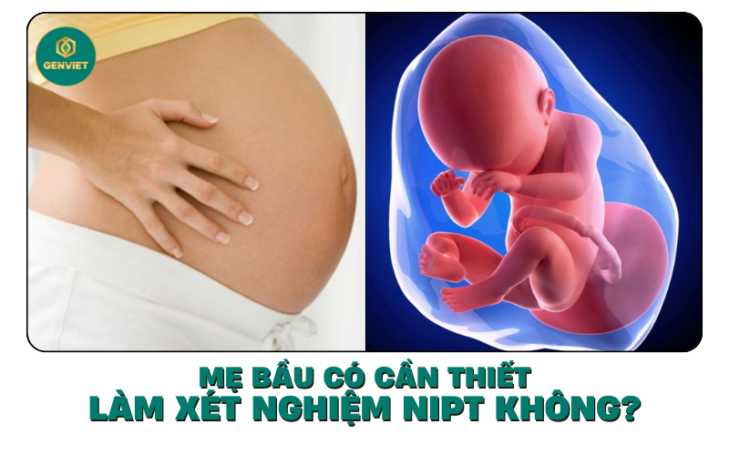 me-bau-co-can-thiet-lam-xet-nghiem-nipt-khong