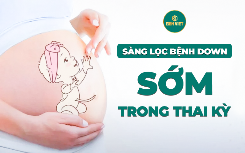 sang-loc-benh-down-som-trong-thai-ky