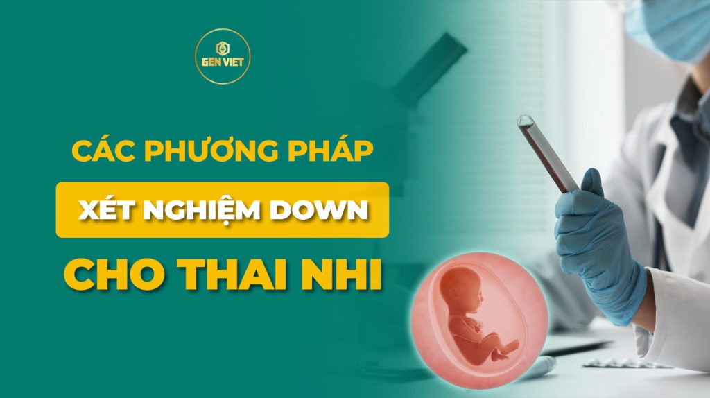 cac-phuong-phap-xet-nghiem-down-cho- thai-nhi