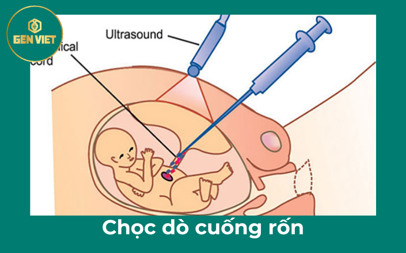 choc-do-cuong-ron