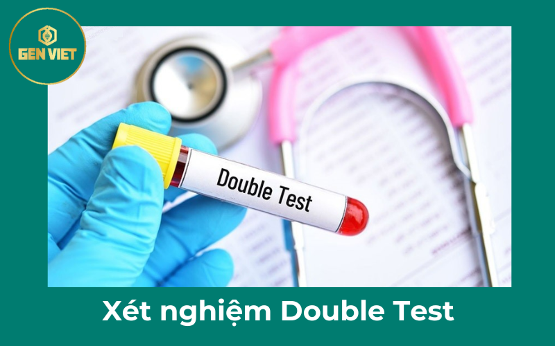 xet-nghiem-double-test-cho-thai-nhi