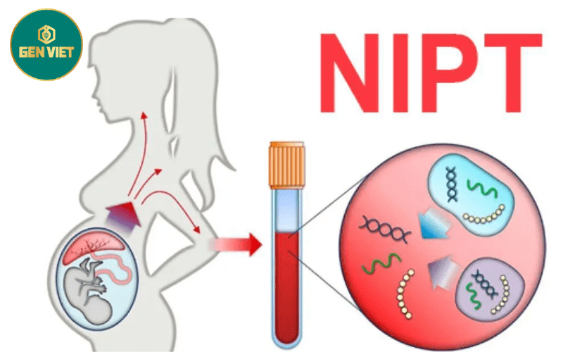 xet-nghiem-nipt-la-gi-min