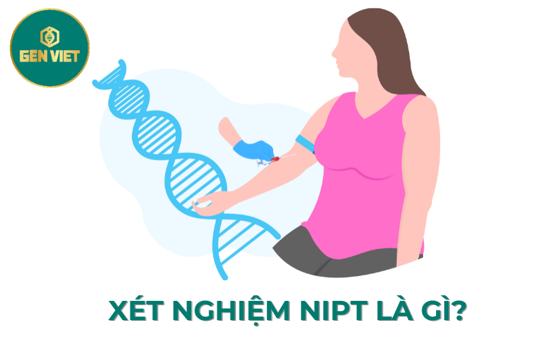 xet-nghiem-nipt-la-gi