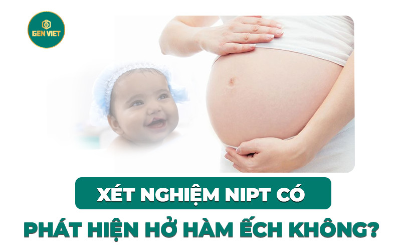 xet-nghiem-nipt-co-phat-hien-ho-ham-ech-khong