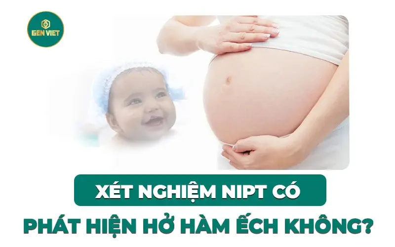 xet-nghiem-sang-loc-nipt-co-phat-hien-ho-ham-ech-khong