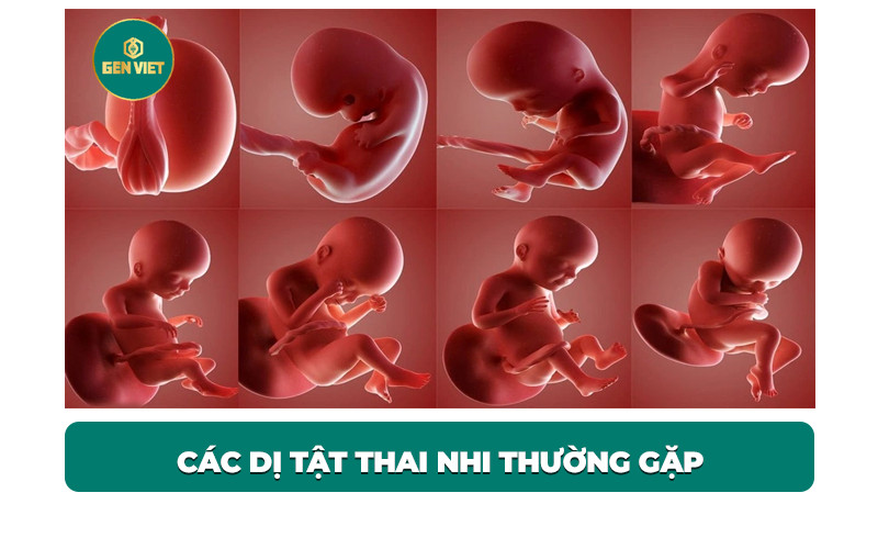 cac-di-tat-thai-nhi-thuong-gap