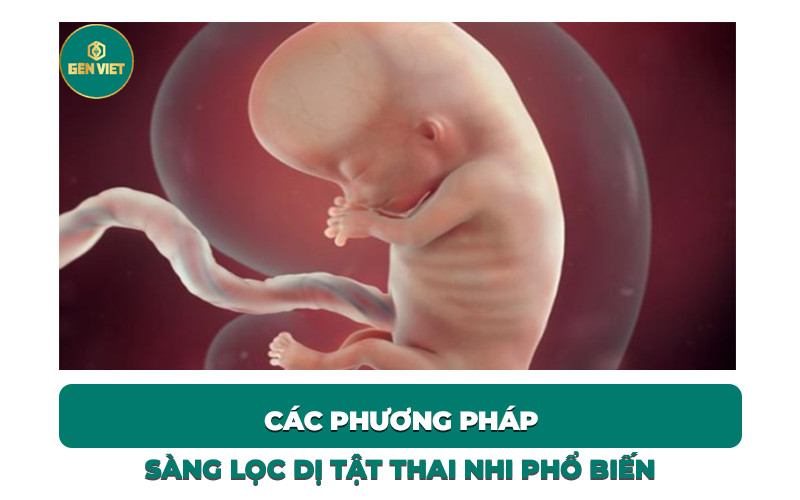 cac-phuong-phap-kham-sang-loc-di-tat-thai-nhi-pho-bien