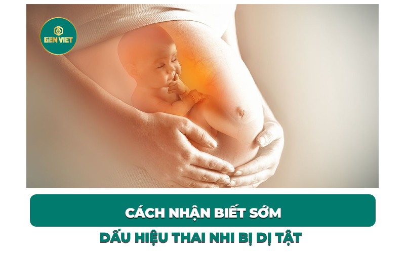 cach-nhan-biet-som-dau-hieu-thai-nhi-bi-di-tat