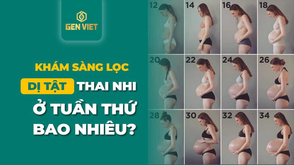 kham-sang-loc-di-tat-thai-nhi-o-tuan-bao-nhieu