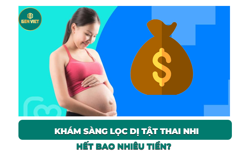 phuong-phap-kham-sang-loc-di-tat-thai-nhi-het-bao-nhieu-tien