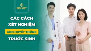 cac-cach-xet-nghiem-adn-huyet-thong-truoc-sinh