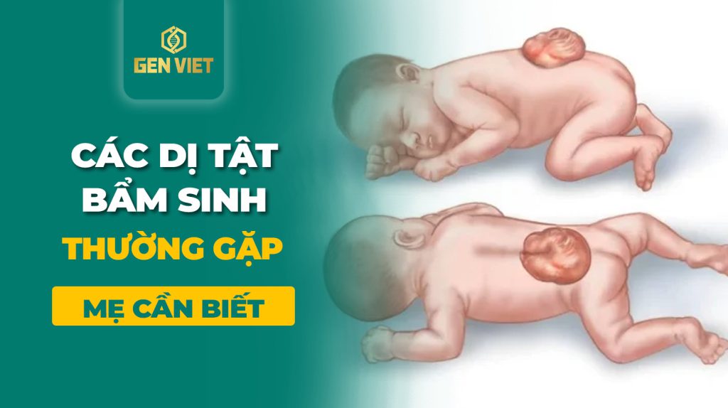 Các dị tật bẩm sinh thường gặp ở thai nhi mẹ bầu nên chú ý