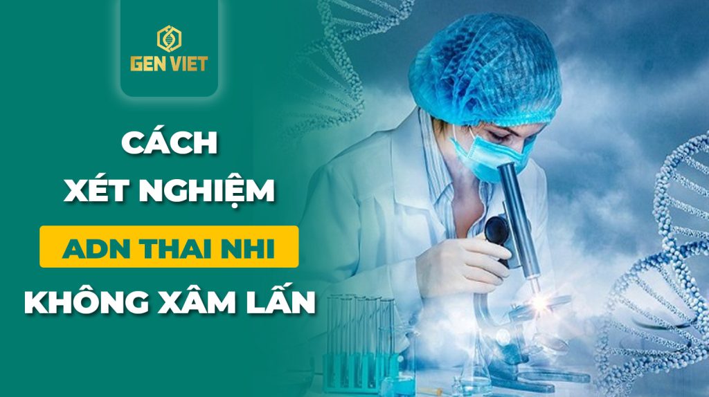 cach-xet-nghiem-adn-thai-nhi-khong-xam-lan