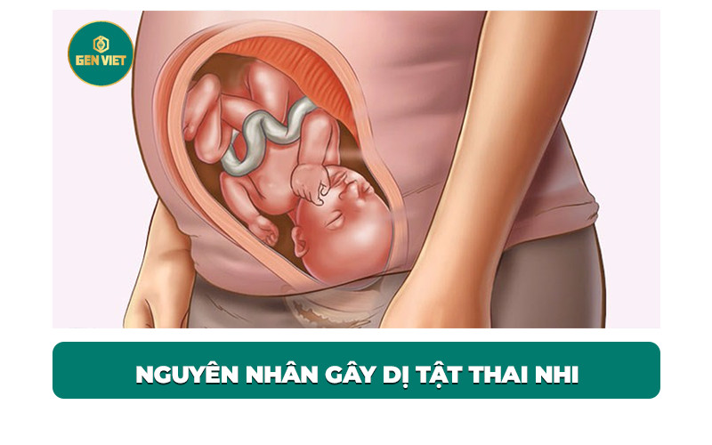 nguyen-nhan-gay-di-tat-bam-sinh-thuong-gap