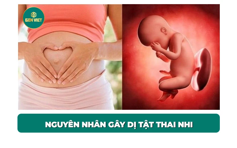 nguyen-nhan-gay-di-tat-thai-nhi