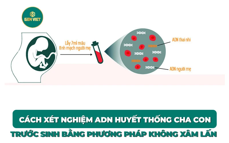 xet-nghiem-adn-cha-con-truoc-sinh-khong-xam-lan