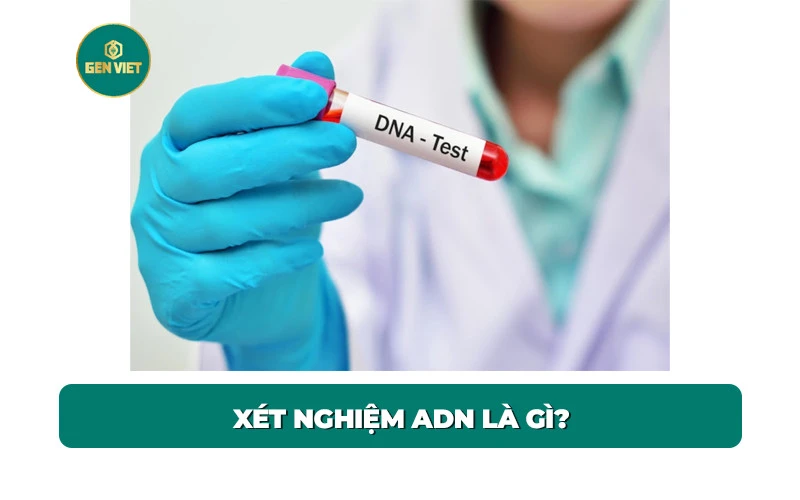 xet-nghiem-adn-la-gi