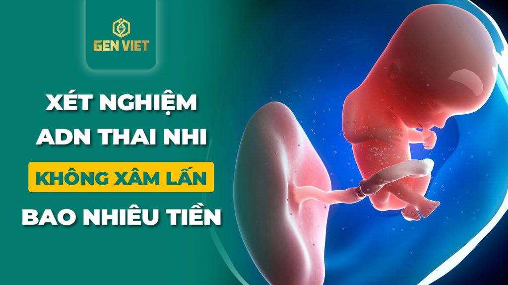 xet-nghiem-thai-nhi-khong-xam-lan-bao-nhieu-tien