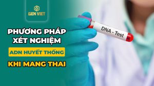 phuong-phap-xet-nghiem-adn-huyet-thong-khi-mang-thai