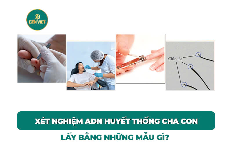 xet-nghiem-adn-huyet-thong-cha-con-bang-nhung-mau-gi