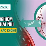 xet-nghiem-adn-thai-nhi-co-chinh-xac-khong