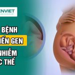 cac-benh-dot-bien-gen-va-nhiem-sac-the